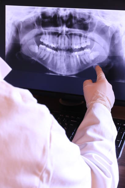 Best Emergency Treatment for Toothache in Palos Park, IL