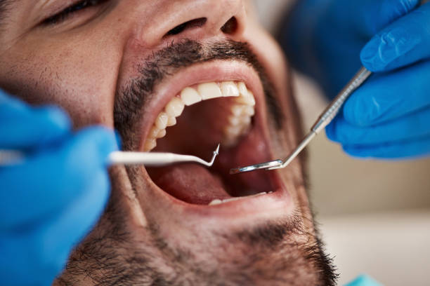 Best Emergency Tooth Extraction in Palos Park, IL